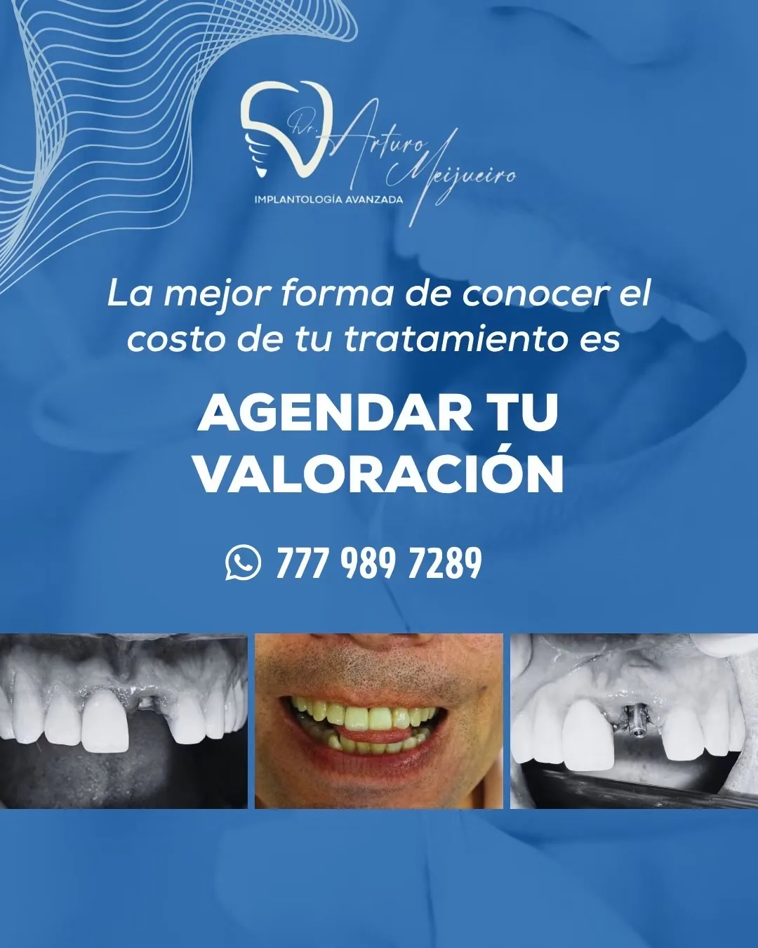 Caso clínico de rehabilitación dental